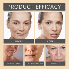Bee Venom Cream for Finelines & Wrinkle