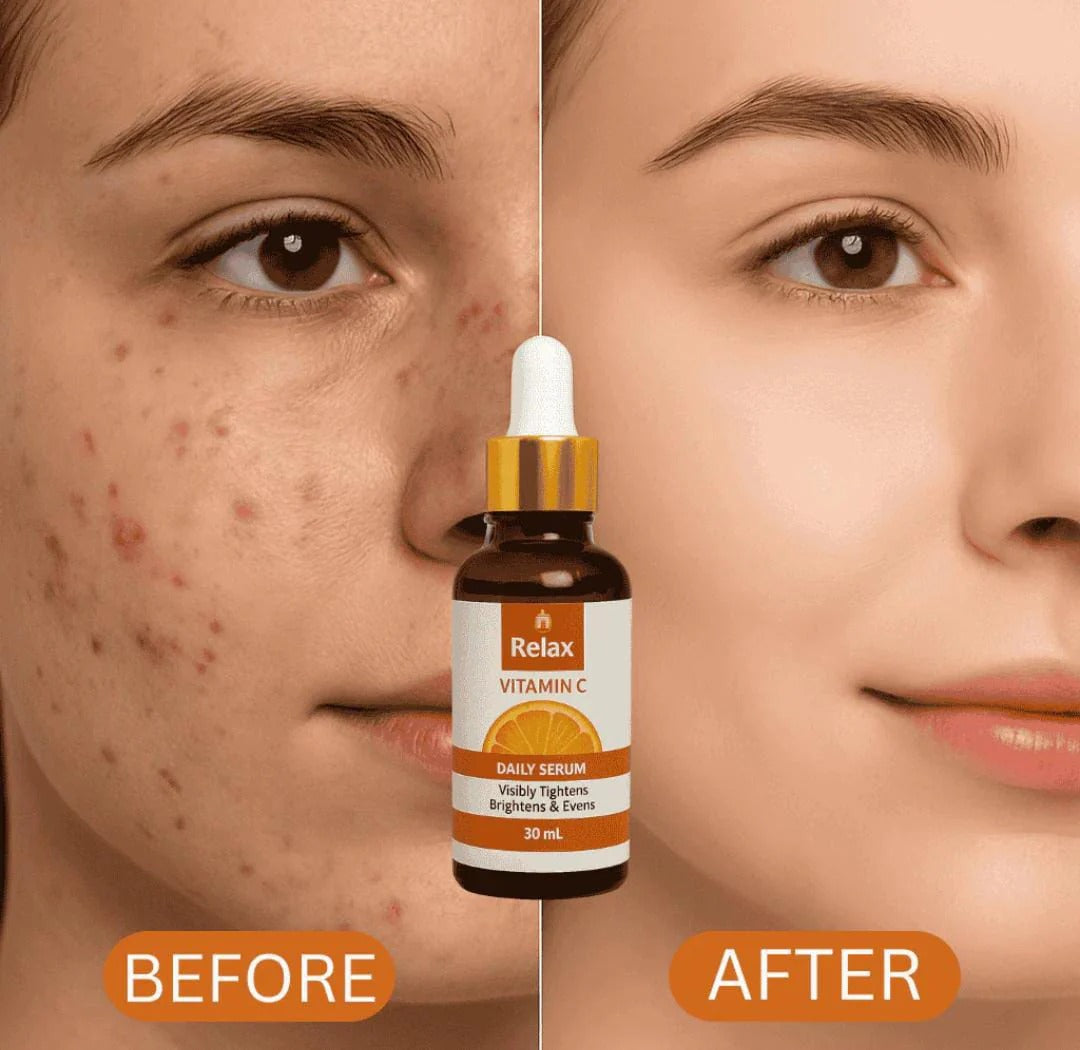 Relax Vitamin C Daily Face Serum – Brightening, Anti-Aging Formula