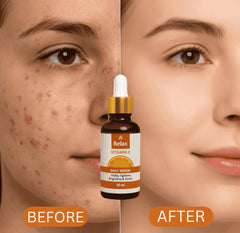 Relax Vitamin C Daily Face Serum – Brightening, Anti-Aging Formula